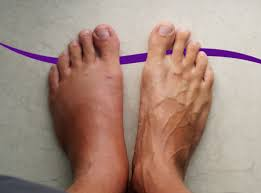 Foot